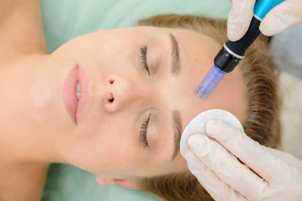 Advanced Microneedling (CIT)